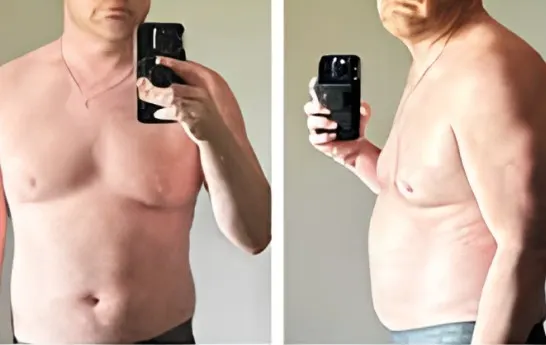 An Axiom patient photographed before and after a medical weight loss program