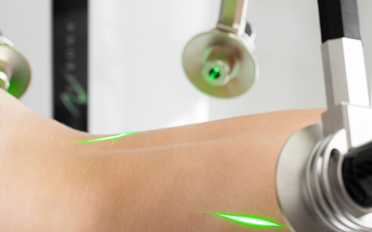 A body contouring applicator being worked across a patient's abdomen